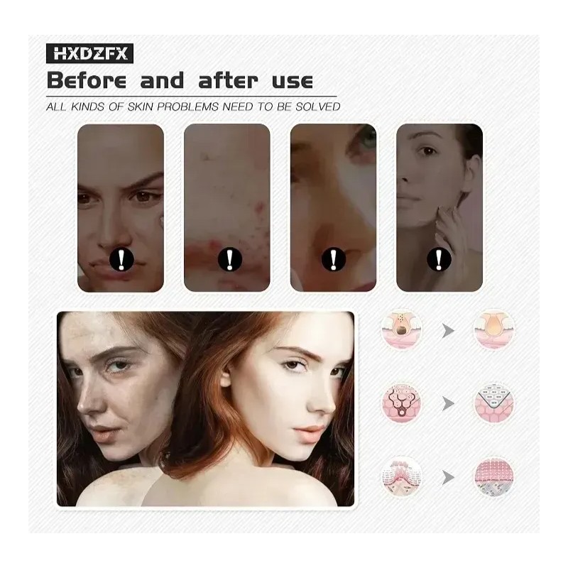 Hxdzfx Máscara Facial De Luz Led 7 Colores Y Funciones