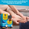MQUPIN Corn Removers for Toes，Extra Strength Corn & Callus Remover