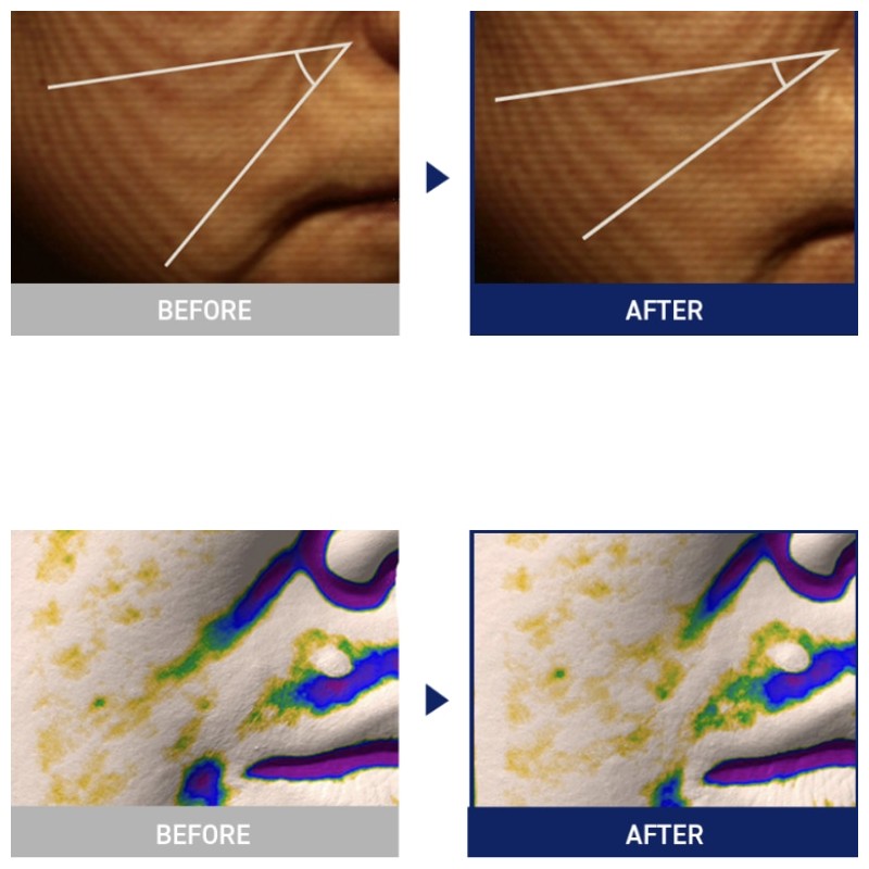 MEDIHEAL Square Toner Pads 200ea, Type:Vitamide Brightening Pad