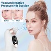 Blackhead Remover Vacuum with Water Chamber, Black Head Remover and