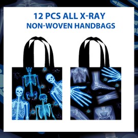12pcs Radiology Gift Treat Bags with Handles Radiology Birthday Party Decorations X Ray Party Non-woven Tote Bags for Doctor Birthday X Ray Medical Theme Party Baby Shower Supplies