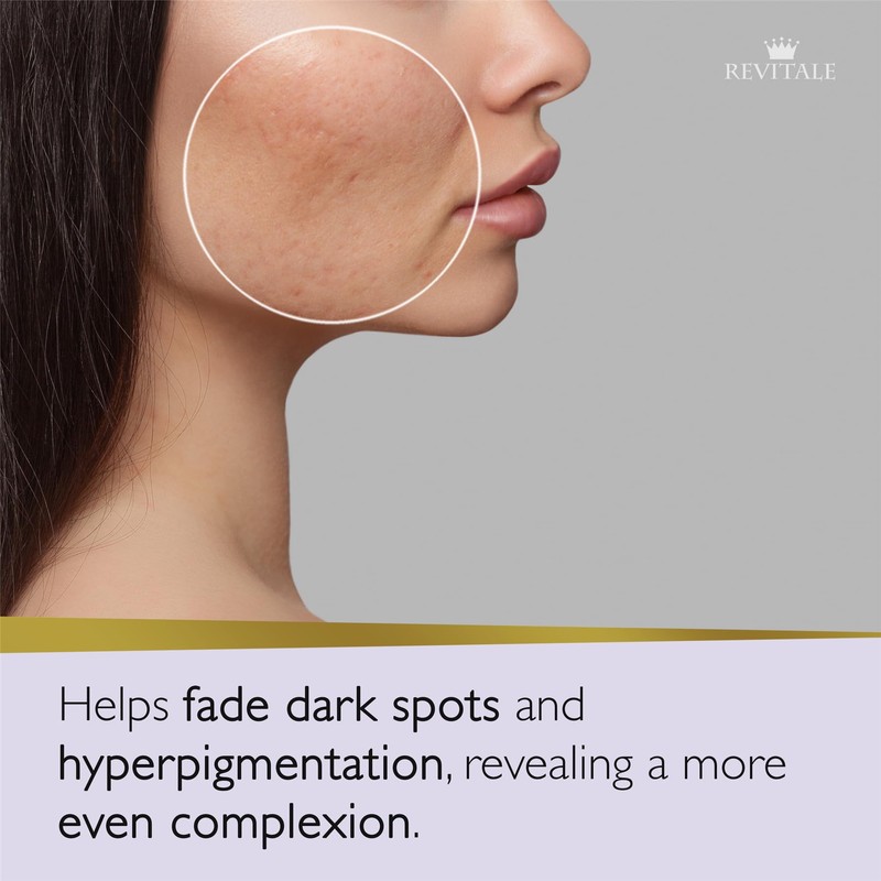 Revitale Advanced Azelaic Acid and Niacinamide Soap