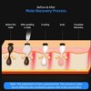 Household Mole Removal Pen 9 Level Adjustable LED Screen Dual