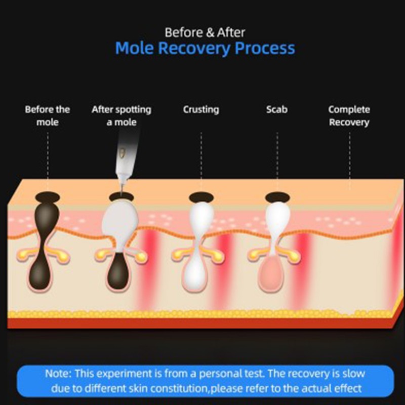 Household Mole Removal Pen 9 Level Adjustable LED Screen Dual