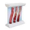 Lipoprotein LDL Blood Vessel Model Low Density Blood Lipid Vessel