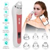 Electric Facial Blackhead Cleansing Vacuum Suction Machine with 20X 5MP