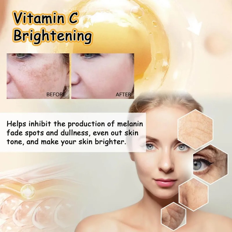 Vc Mist Vc Bruma Hidratante Útil Para Rostro De Todo