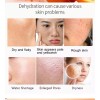 Loción Iluminadora Con Vitamina C, Sérum Hidratante, 30 Ml
