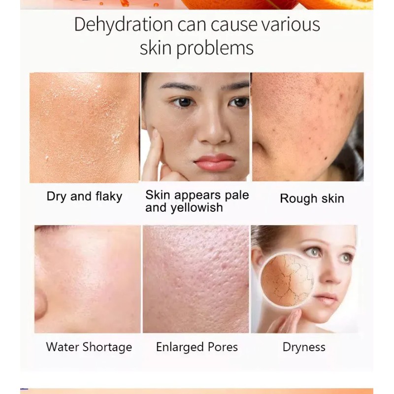 Loción Iluminadora Con Vitamina C, Sérum Hidratante, 30 Ml