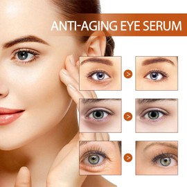 Lumi Eye Balm Cream,Lumi Eye Balm for Under Eye Bags,Erases Eye Bags within Minutes,Eye Ba-lm Bags Reducer,E-ye Cre-am Anti Aging,E-ye Cre-am for Dark Circles and Puffy E-yes,Under E-ye Cream