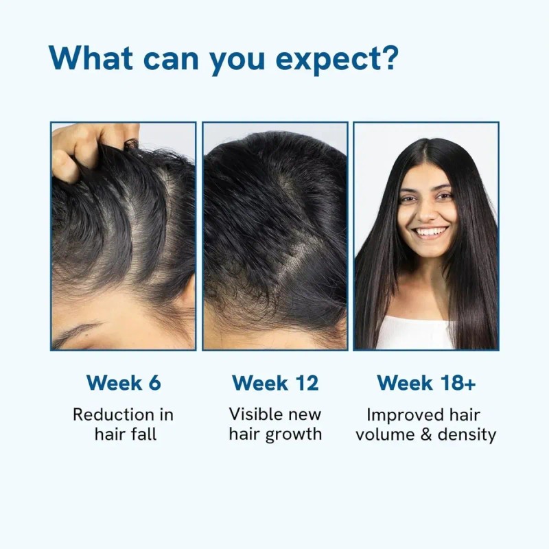 1pcs Rosemary Repara El Cabello Dañado Y Suaviza El Frizz