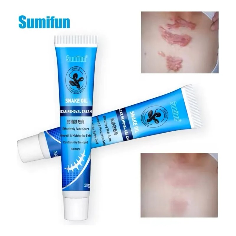 2 Pomadas Quirúrgica Elimina Cicatrices Sumifun