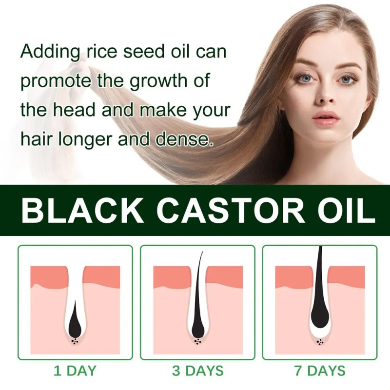 Para El Hogar, Aceite De Ricino Negro Hoegoa Para Cabello
