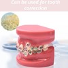 Small Orthodontic Elastic Bands - 5PCS/Pack, for Teeth Braces, Dental,