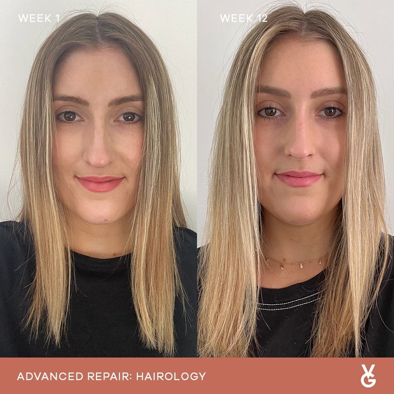 Vida Glow Hairology Advanced Repair - 30 Capsules