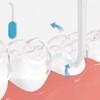 Aligner Removal Tool, 4Pcs Retainer Remover Tool-PortableTravel, Dental kit for
