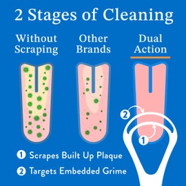 Mouthology Tongue Scraper for Adults (2 Pack), Reduce Bad Breath, Metal Tongue Scraper, Tongue Cleaner, Tongue Scraper, Stainless Steel Tongue Scraper, Tongue Cleaner for Adults, Tongue Scrubber