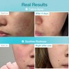 No.1 Pantothenic B5 Hyaluronic Active Clear Mask (10ea)