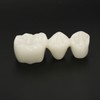Teeth Implant Model Transparent Dental Teaching Research Demonstration Teeth Model