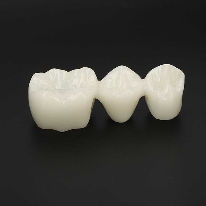 Teeth Implant Model Transparent Dental Teaching Research Demonstration Teeth Model