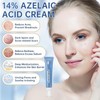 Azelaic Acid face serum cream for Redness Relief,Dark Spots,Azelaic Acid