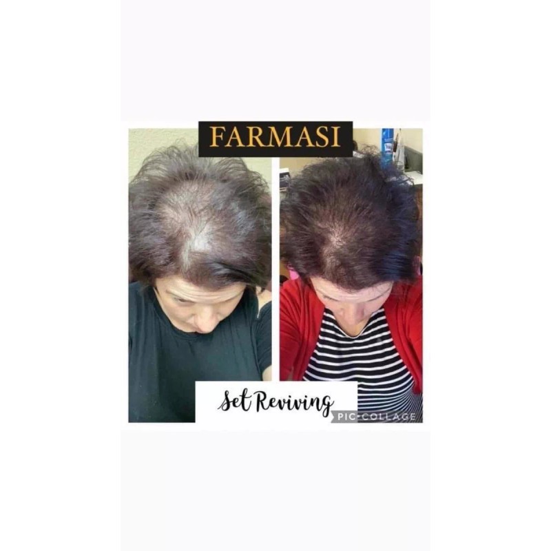 Dr. C. Tuna Tratamiento Completo Caída Para Cabello Reviving Dr.