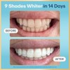 Lumineux Tiras blanqueadoras de dientes 21 tratamientos - Sin peróxido