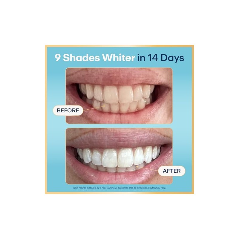 Lumineux Tiras blanqueadoras de dientes 21 tratamientos - Sin peróxido