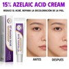 Ácido Azelaico 15% Suero Facial Hidratante – 20g Tuzkevla