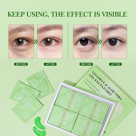 Yeokoe Parches Para Ojeras E Hinchazón 20 Pares De Mascarillas Faciales Con Vitamina E Y Gel De Aloe Vera Para Rejuvenecer Verde