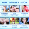 BRUIZEX Ultra Bromelain and Quercetin Bruising Relief Supplement, 120 Capsules