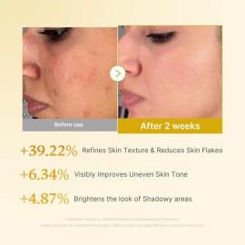Medicube Kojic Acid Turmeric Resurfacing Toner 250ml Todo Tipo De Piel Día/noche