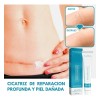 Crema Manchas Despigmentante Melasma Acné Paño Cicatrices
