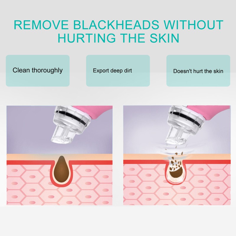 Small Bubble Blackhead Removal Suction Instrument Portable Electric Face Pore