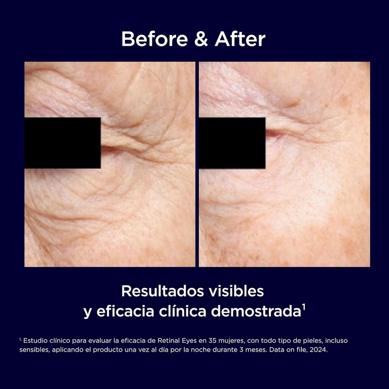 Isdin Serum Facial Ceutics Retinal Eyes 20ML