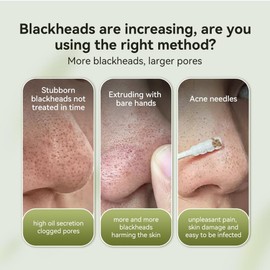 Lanbena Blackhead Mask Nose Plant Pore Strip Remover Peel Off Facial Cleanser Purifying Face (1.06 oz) - White / 란베나 블랙헤드 마스크 코 식물 모공 스트립 리무버 필 오프 페이셜 클렌저 퓨리파이징 페이스 (1.06온스) - 화이트