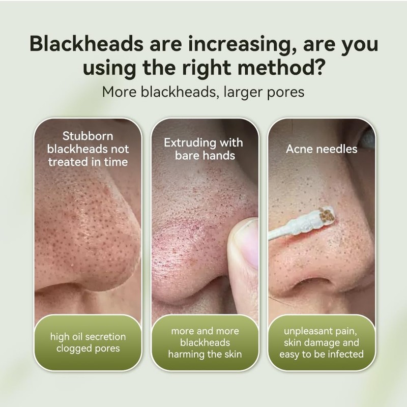 Lanbena Blackhead Mask Nose Plant Pore Strip Remover Peel Off