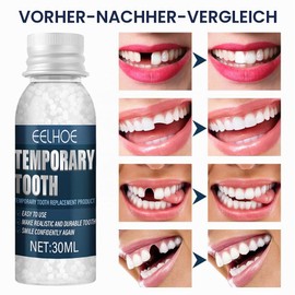 OYZOQ Temporary Dentures, Tooth Repair Set, Dental Filling Yourself, for Repairing Broken Teeth, 30 ml