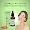 Soodox Organic Frankincense Oil - 100% Organic Essential Oil -