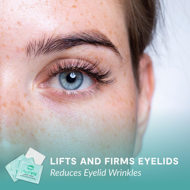Eyelid Cleanser Wipes - 30 Single-Use Towelettes - Gentle, Hypoallergenic