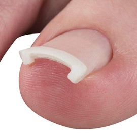 Plus Walk General Medical Devices, Corrective Nail Seal, Elastic Resin Hook, Thin Transparent Seal, Cyprus