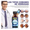Eliminar Rápidamente Tratamento De Verrugas E Hpv Líquido