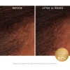 Tratamiento Tnico Para El Cuero Cabelludo Moroccanoil Que R