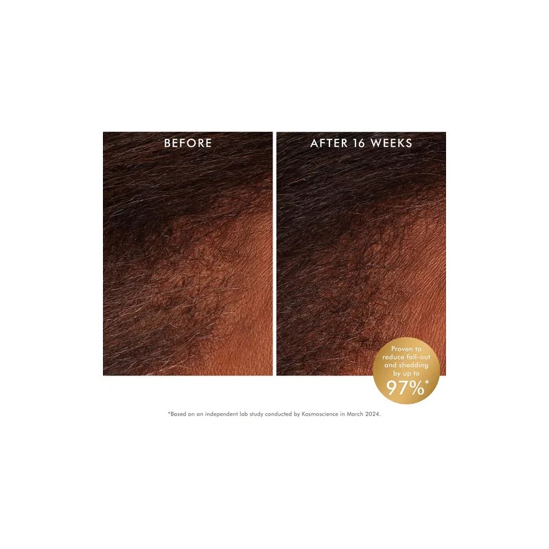 Tratamiento Tnico Para El Cuero Cabelludo Moroccanoil Que R