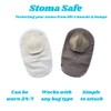 Stoma Safe | Stoma Protector | Stoma Shield | Ostomy