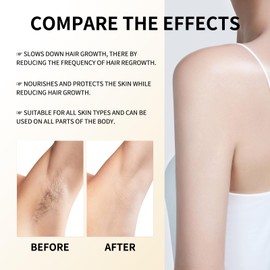 Cyperus Rotundus Oil,Cyprus Oil for Hair Removal Natural Hair Removal Solution Reducing Body Hair Growth, Smooth Skin & Moisturizing for All Skin Types