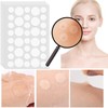 Rpanle Acne Patches[180 Pcs], Invisible Hydrocolloid Spot Patches, Dots for