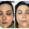 Anti-pigment Sérum Facial Anti-manchas