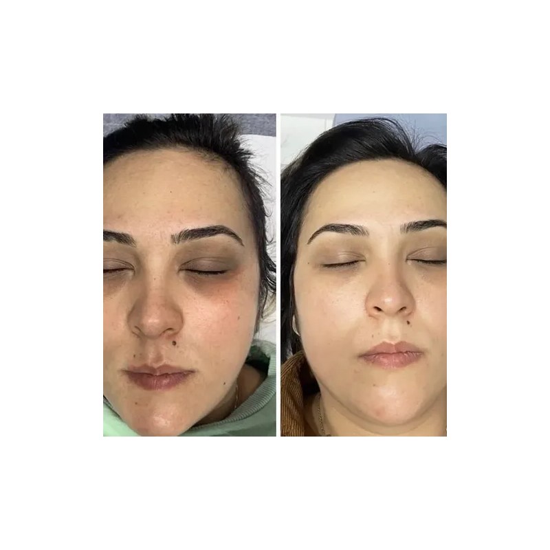 Anti-pigment Sérum Facial Anti-manchas