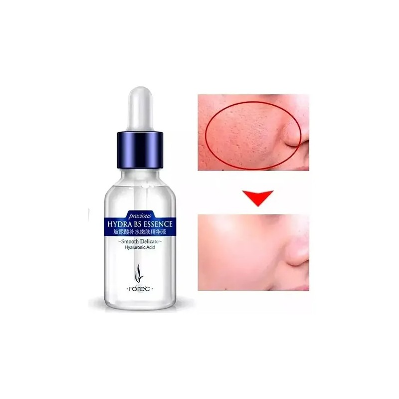 Kit Facial B5 Serum Arroz Hydrata Disminuye Arrugas Full